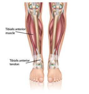 tibialis anterior