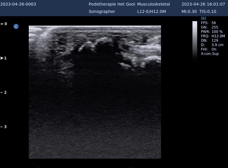 bipartite sesamsbeentje