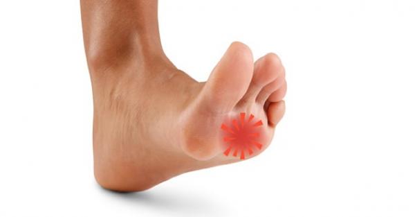 slijmbeurs ontsteking